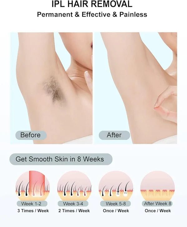 BabyVerse Professional IPL Laser Permanent Hair Removal - Galaxiee.comHair Removal