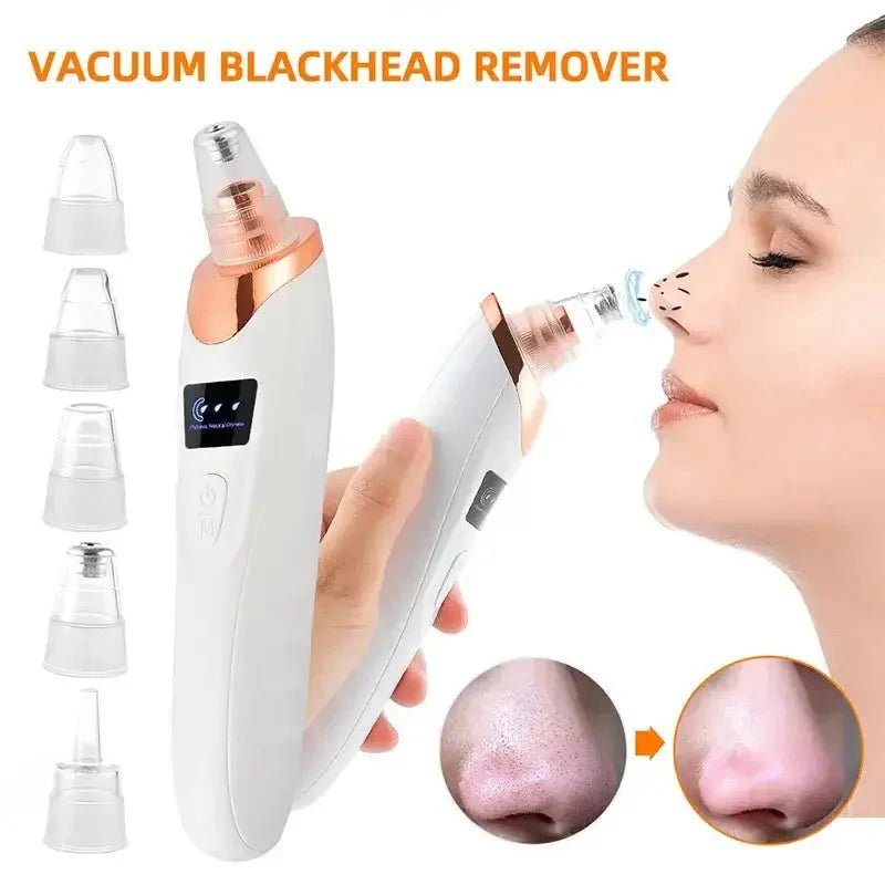 5 in 1 Rechargeable Vacuum Blackhead Remover - Buy Online Pakistan | Galaxiee.com