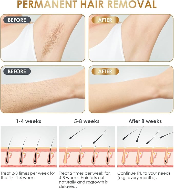 BabyVerse Professional IPL Laser Permanent Hair Removal - Galaxiee.comHair Removal