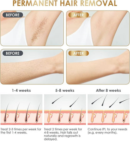 BabyVerse Professional IPL Laser Permanent Hair Removal - Galaxiee.comHair Removal